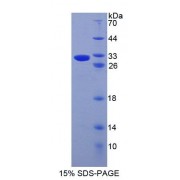SDS-PAGE analysis of Human ABCD4 Protein.