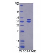 SDS-PAGE analysis of Mouse ABCG5 Protein.