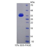 SDS-PAGE analysis of Rat ABCG8 Protein.