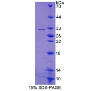 SDS-PAGE analysis of Human ABCG4 Protein.