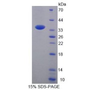 SDS-PAGE analysis of Human ACAA2 Protein.