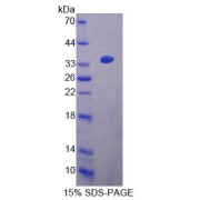SDS-PAGE analysis of Mouse ACAA2 Protein.