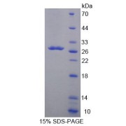 SDS-PAGE analysis of Human ACADL Protein.