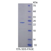 SDS-PAGE analysis of Human ACADS Protein.