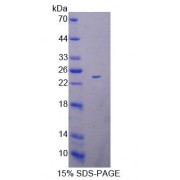SDS-PAGE analysis of Mouse ACADS Protein.