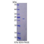 SDS-PAGE analysis of Mouse ACADS Protein.