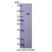 SDS-PAGE analysis of Human ACAT1 Protein.