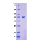 SDS-PAGE analysis of Mouse COASY Protein.