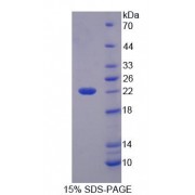 SDS-PAGE analysis of Mouse HADH Protein.
