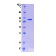 SDS-PAGE analysis of Rat HMGCR Protein.