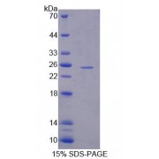 SDS-PAGE analysis of recombinant Mouse HMGCS2 Protein.