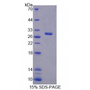 SDS-PAGE analysis of Human IVD Protein.