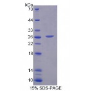 SDS-PAGE analysis of Human MCCC2 Protein.