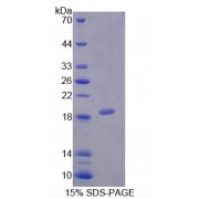 SDS-PAGE analysis of Human PCCa Protein.