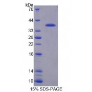 SDS-PAGE analysis of Mouse RGS9 Protein.