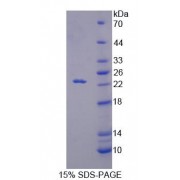 SDS-PAGE analysis of Mouse RGS10 Protein.