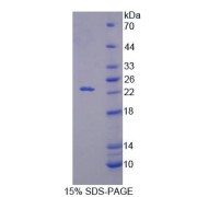 SDS-PAGE analysis of Mouse RGS10 Protein.