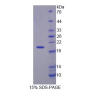 SDS-PAGE analysis of Human RGS7 Protein.