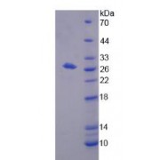 SDS-PAGE analysis of recombinant Human Bisphosphoglycerate Mutase Protein.