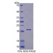 SDS-PAGE analysis of Mouse BPGM Protein.