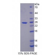 SDS-PAGE analysis of Rat PDP2 Protein.