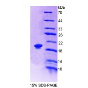 SDS-PAGE analysis of Rat LRP11 Protein.