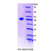 SDS-PAGE analysis of Rat GPC5 Protein.