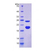 SDS-PAGE analysis of Rat AVPI1 Protein.