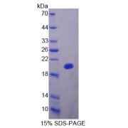 SDS-PAGE analysis of Human DTYMK Protein.