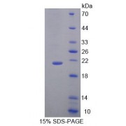 SDS-PAGE analysis of Mouse DTYMK Protein.