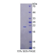 SDS-PAGE analysis of Rat DTYMK Protein.