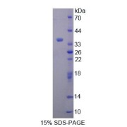 SDS-PAGE analysis of Rat C8a Protein.