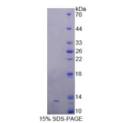 SDS-PAGE analysis of Rat GALP Protein.