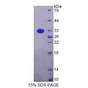 SDS-PAGE analysis of Rat TOP1MT Protein.