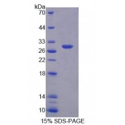 SDS-PAGE analysis of Mouse TOPBP1 Protein.