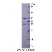 SDS-PAGE analysis of Rat TOPBP1 Protein.