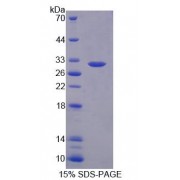 SDS-PAGE analysis of Human PLA2G3 Protein.