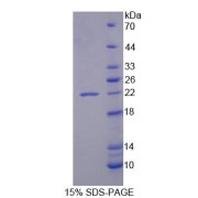 SDS-PAGE analysis of Human PLA2G12 Protein.