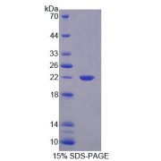 SDS-PAGE analysis of Mouse PLA2G12 Protein.