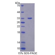 SDS-PAGE analysis of Human PLCb2 Protein.