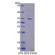 SDS-PAGE analysis of Human PLCd1 Protein.