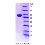 SDS-PAGE analysis of Mouse PLCe1 Protein.