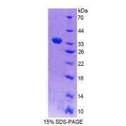 SDS-PAGE analysis of recombinant Rat PLCe1 Protein.