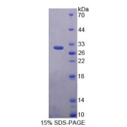 SDS-PAGE analysis of Human PLCh2 Protein.