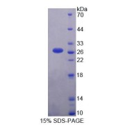 SDS-PAGE analysis of Human PLCL1 Protein.