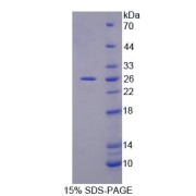 SDS-PAGE analysis of Mouse PLCL1 Protein.