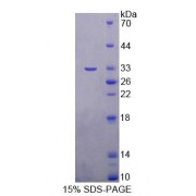 SDS-PAGE analysis of Human AGXT2 Protein.