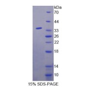 SDS-PAGE analysis of Rat AGXT2 Protein.