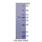 SDS-PAGE analysis of Human BCAT1 Protein.