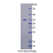 SDS-PAGE analysis of Human TAT Protein.